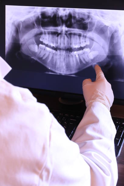 Best Teeth Whitening  in Rich Hill, MO