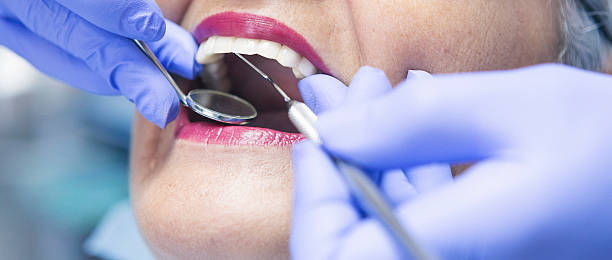 Best Dentist for Tooth Abscess  in Rich Hill, MO